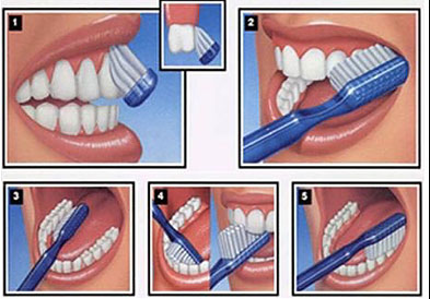 How to clearance brush teeth properly