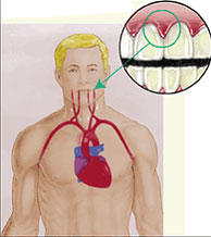 demonstrating the relationship between heart disease and periodontal disease