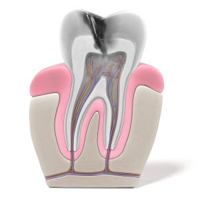 What Is a Root Canal