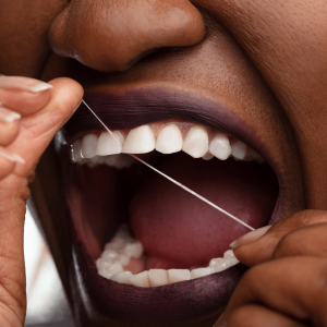 3 Secrets to Make Flossing Simpler