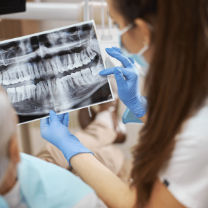 What Are Digital Dental X-Rays